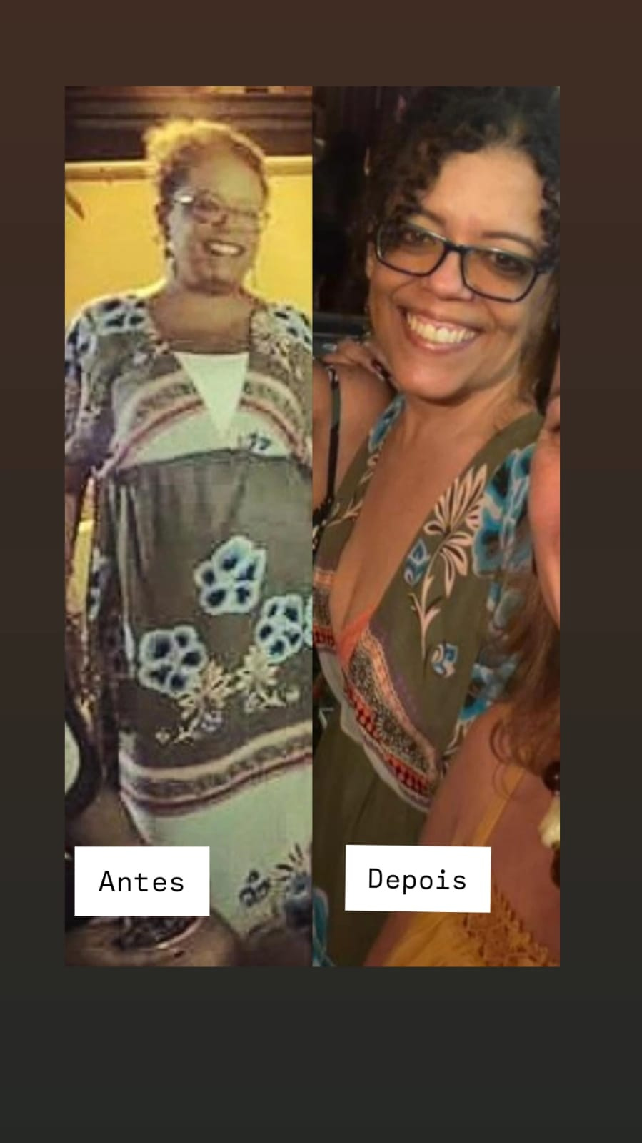 Ana Cristina antes e depois do emagrecimento, comparação lado a lado
